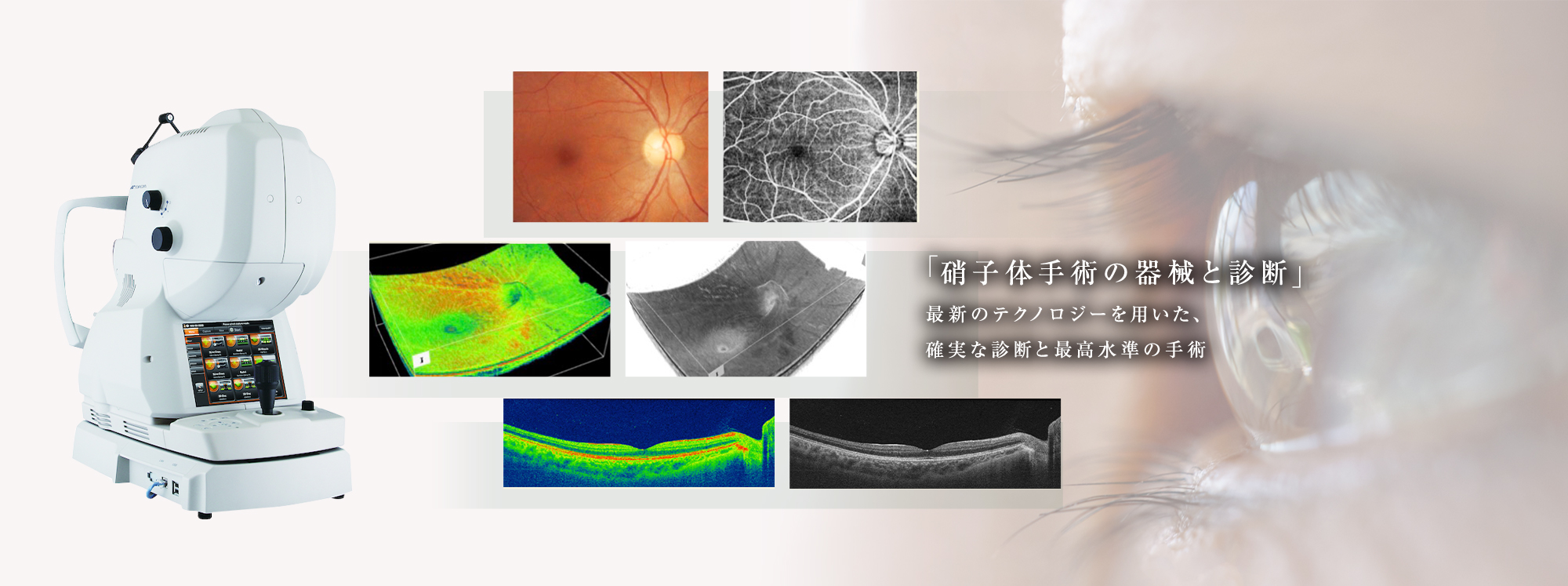 「硝子体手術の器械と診断」最新のテクノロジーを用いた、確実な診断と最高水準の手術